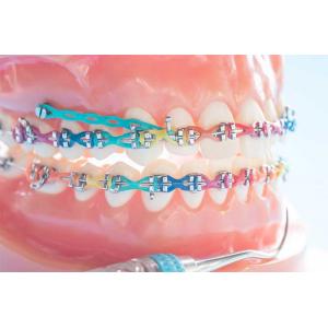 ORTODONTİK TEDAVİDE MİNİ VİDA UYGULAMASI