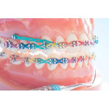 ORTODONTİK TEDAVİDE MİNİ VİDA UYGULAMASI