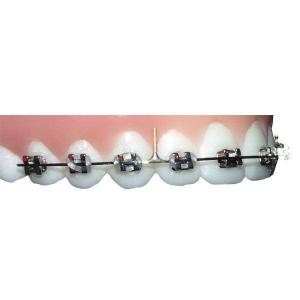 POSTED ARW WIRE 0.18X25 44 MM