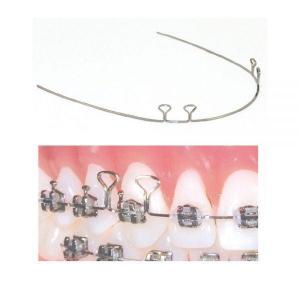 T-LOOP 19X25 40 MM