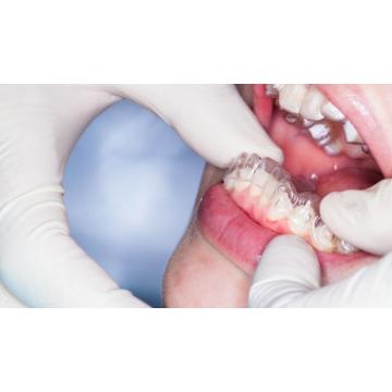 Plakları Takıp Çıkarırken Nelere Dikkat Edilmelidir?